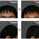 Image for article titled "Round Head" Plastic Surgery Seems Excessive, Even for South Korea